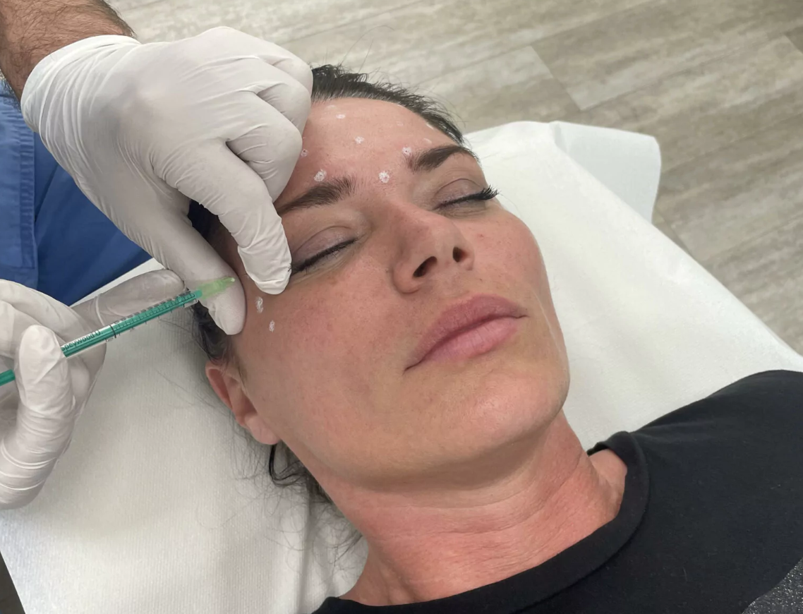 Frau liegt auf einem Operationstisch. Hand in weißen Hygienehandschuhen führt eine Botoxbehandlung im Gesicht mit einer Spritze durch